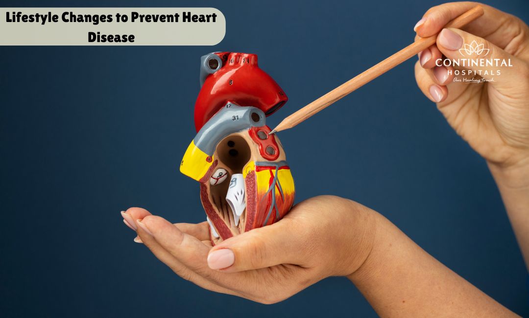 Lifestyle Changes to Prevent Heart Disease How To Support Heart Health With Lifestyle Changes